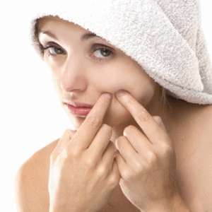 Esthetica MD Acne Misconceptions